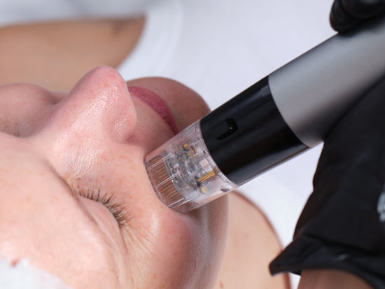 The Ultimate RF Microneedling Showdown - Morpheus 8 vs. Lutronic Genius