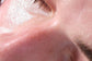KICHI BABY FACE: LASER FACIAL